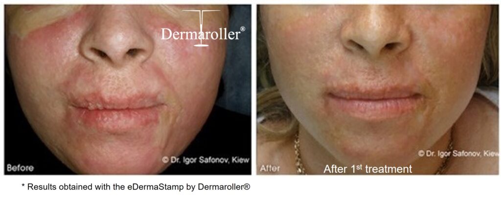 B&A_10