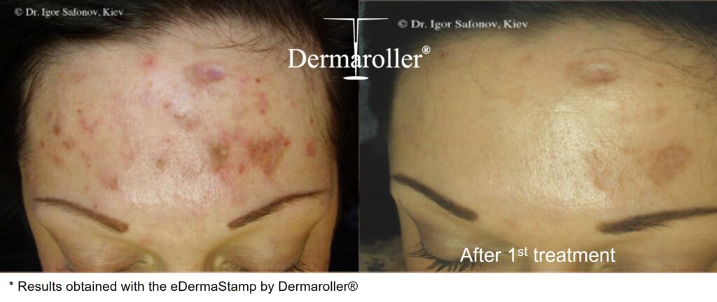 B&A_2
