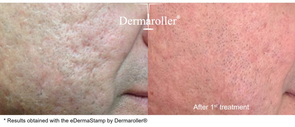 B&A_6