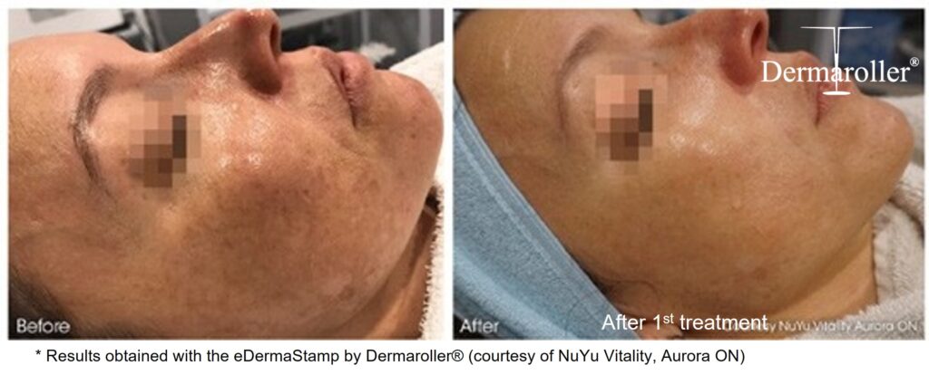 B&A_7