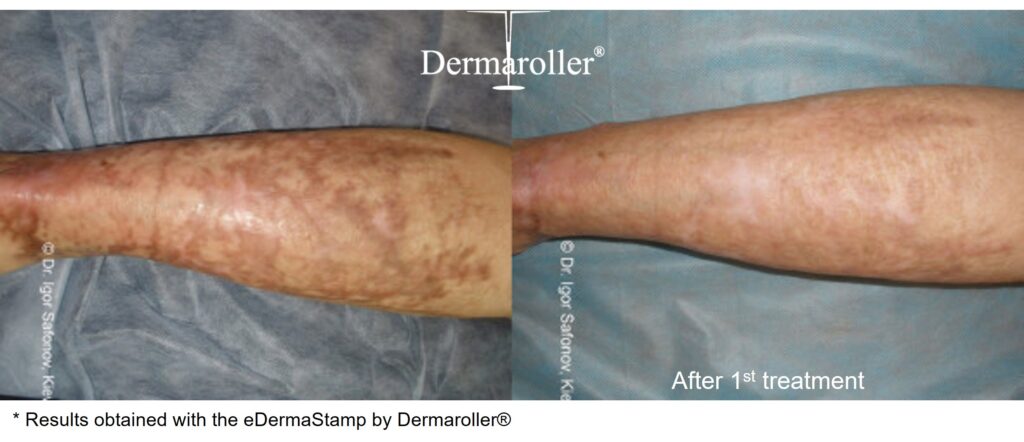 B&A_9